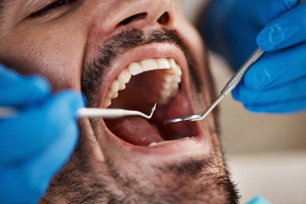 Best Dentist for Tooth Abscess  in Riverdale Park, MD