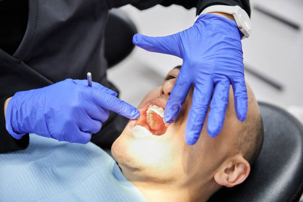 Best Knocked-Out Tooth Emergency  in Riverdale Park, MD